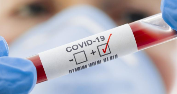 COVID -19 Šalčininkų rajone: fiksuojami protrūkiai 