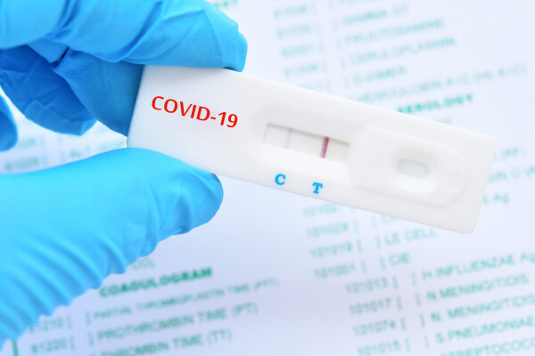 COVID-19: sergamumas ir tyrimai 